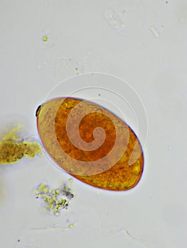 Egg of intestinal fluke in human stool