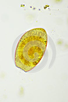 Egg of intestinal fluke in human stool