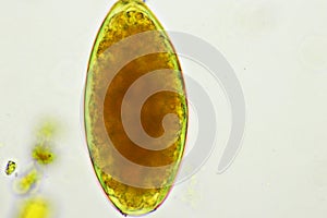 Egg of intestinal fluke in human stool