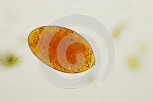 Egg of intestinal fluke in human stool