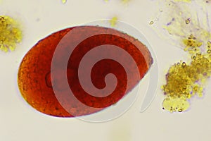 Egg of intestinal fluke in human stool