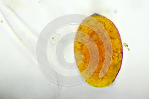 Egg of intestinal fluke in human stool