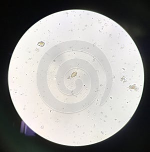 Egg parasite human in stool examination