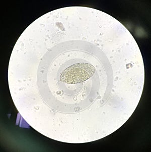 Egg parasite human in stool examination