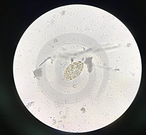 Egg parasite human in stool examination