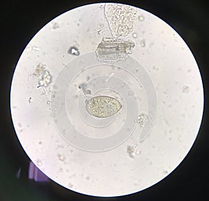Egg parasite human in stool examination