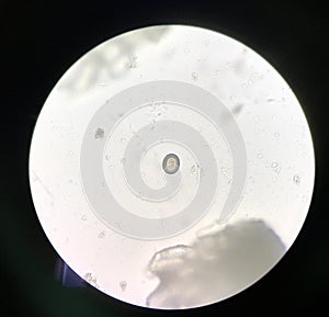 Egg parasite human in stool examination