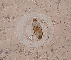 Egg parasite in stool exam