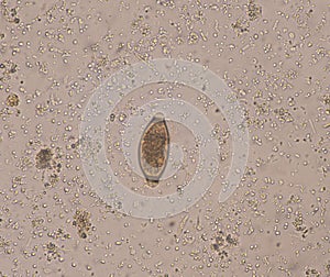 Egg parasite in stool exam
