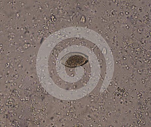 Egg parasite in stool exam