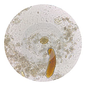 Egg of parasite in stool exam