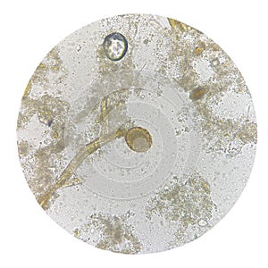 Egg of parasite in stool exam