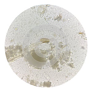 Egg of parasite in stool exam