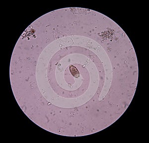 Egg parasite.