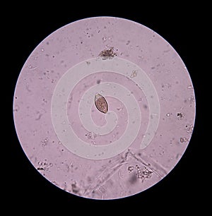 Egg parasite.