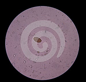 Egg parasite.