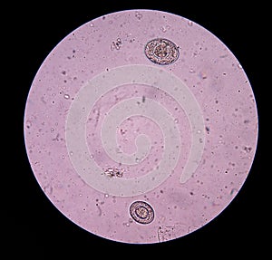 Egg parasite.