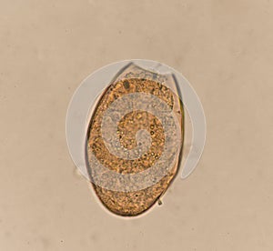 Egg parasite in stool human