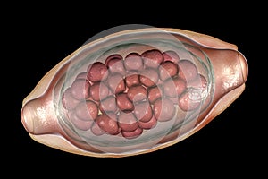 Egg of parasitic roundworm Trichuris trichiura