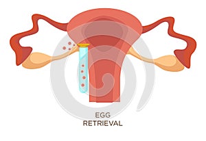 Vajcia nájdenie fáza v oplodnenie umelý inseminácia 