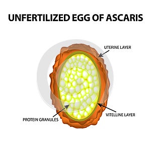 The egg of the roundworm unfertilized. Structure of Ascaris eggs. infographics. Vector illustration on isolated background.