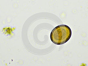 Egg of Taenia or tapeworm in human stool