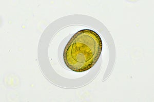 Egg of Taenia or tapeworm in human stool