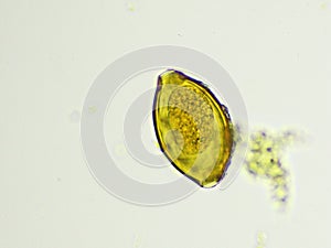 Egg of Trichuris trichiura in human stool