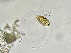Egg of Trichuris trichiura