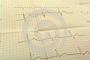 EGGor ECG paper the ECG Is the result of Stress test and pink heart shape out of pills. The promotion package to check your heart