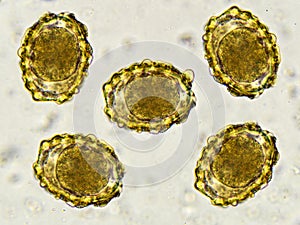 Eggs of Ascaris lumbricoides (roundworm) photo