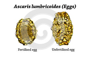 Eggs of Ascaris lumbricoides (roundworm) photo