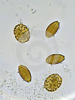 Eggs of helminthes