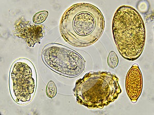 Eggs of helminthes in stool