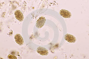 Eggs of Hookworm in human stool