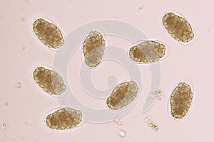 Eggs of Hookworm in human stool