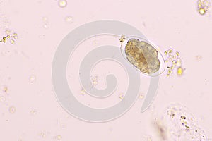 Eggs of Hookworm in human stool
