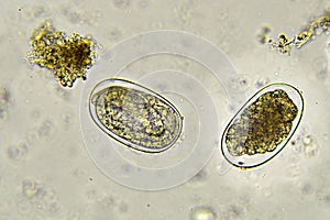 Eggs of Hookworm in stool