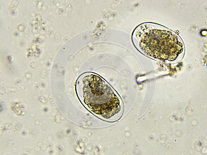 Eggs of Hookworm in stool