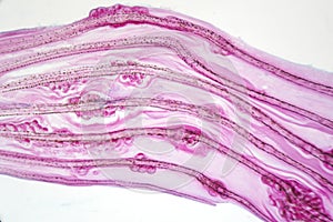 Eggs liver flukeParasitic flatworm infection in fish fin.