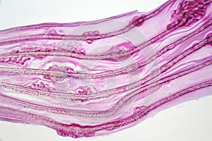 Eggs liver flukeParasitic flatworm infection in fish fin.