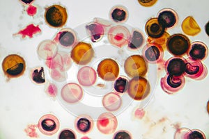 Eggs of tapeworm Taenia, pork tapeworm