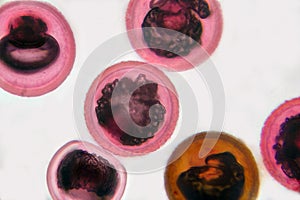 Eggs of tapeworm Taenia, pork tapeworm