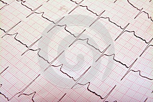 Ekg