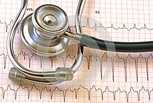 Ekg