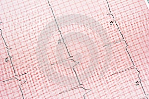 EKG background