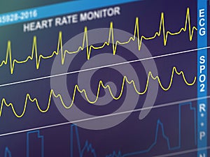 EKG cardiac frequency