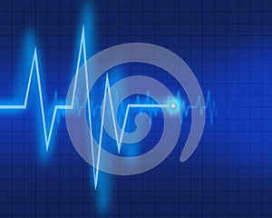 EKG chart photo