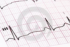 Ekg/ ecg as a background