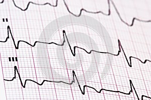 Ekg/ ecg as a background